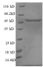 (Tris-Glycine gel) Discontinuous SDS-PAGE (reduced) with 5% enrichment gel and 15% separation gel. (Tris-Glycine gel) Discontinuous SDS-PAGE (reduced) with 5% enrichment gel and 15% separation gel.