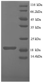 (Tris-Glycine gel) Discontinuous SDS-PAGE (reduced) with 5% enrichment gel and 15% separation gel. (Tris-Glycine gel) Discontinuous SDS-PAGE (reduced) with 5% enrichment gel and 15% separation gel.
