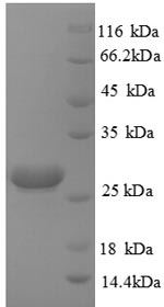 (Tris-Glycine gel) Discontinuous SDS-PAGE (reduced) with 5% enrichment gel and 15% separation gel.