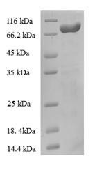 (Tris-Glycine gel) Discontinuous SDS-PAGE (reduced) with 5% enrichment gel and 15% separation gel. (Tris-Glycine gel) Discontinuous SDS-PAGE (reduced) with 5% enrichment gel and 15% separation gel.