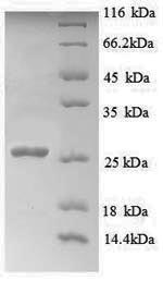 Recombinant Human Myelin transcription factor 1 (MYT1) , partial - image 1