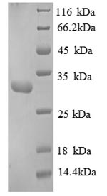 (Tris-Glycine gel) Discontinuous SDS-PAGE (reduced) with 5% enrichment gel and 15% separation gel. (Tris-Glycine gel) Discontinuous SDS-PAGE (reduced) with 5% enrichment gel and 15% separation gel.