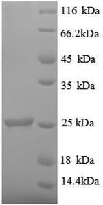 (Tris-Glycine gel) Discontinuous SDS-PAGE (reduced) with 5% enrichment gel and 15% separation gel. (Tris-Glycine gel) Discontinuous SDS-PAGE (reduced) with 5% enrichment gel and 15% separation gel.