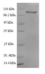 (Tris-Glycine gel) Discontinuous SDS-PAGE (reduced) with 5% enrichment gel and 15% separation gel. (Tris-Glycine gel) Discontinuous SDS-PAGE (reduced) with 5% enrichment gel and 15% separation gel.