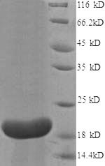 Recombinant Human Interleukin-18-binding protein (IL18BP) , partial - image 1