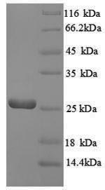 (Tris-Glycine gel) Discontinuous SDS-PAGE (reduced) with 5% enrichment gel and 15% separation gel. (Tris-Glycine gel) Discontinuous SDS-PAGE (reduced) with 5% enrichment gel and 15% separation gel.