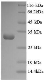 SDS-PAGE- Recombinant protein Human LOX