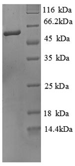(Tris-Glycine gel) Discontinuous SDS-PAGE (reduced) with 5% enrichment gel and 15% separation gel. (Tris-Glycine gel) Discontinuous SDS-PAGE (reduced) with 5% enrichment gel and 15% separation gel.