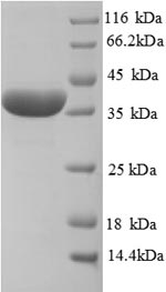 (Tris-Glycine gel) Discontinuous SDS-PAGE (reduced) with 5% enrichment gel and 15% separation gel. (Tris-Glycine gel) Discontinuous SDS-PAGE (reduced) with 5% enrichment gel and 15% separation gel.