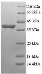 (Tris-Glycine gel) Discontinuous SDS-PAGE (reduced) with 5% enrichment gel and 15% separation gel. (Tris-Glycine gel) Discontinuous SDS-PAGE (reduced) with 5% enrichment gel and 15% separation gel.
