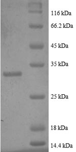 Recombinant Human Metallothionein-2 (MT2A) , partial - image 1