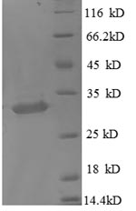 SDS-PAGE- Recombinant protein Human MT1X