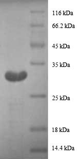 Recombinant Human Metallothionein-1G (MT1G) , partial - image 1