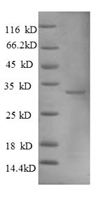 SDS-PAGE- Recombinant protein Human MT1A