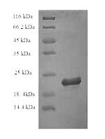 (Tris-Glycine gel) Discontinuous SDS-PAGE (reduced) with 5% enrichment gel and 15% separation gel. (Tris-Glycine gel) Discontinuous SDS-PAGE (reduced) with 5% enrichment gel and 15% separation gel.