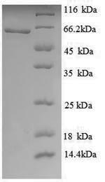 (Tris-Glycine gel) Discontinuous SDS-PAGE (reduced) with 5% enrichment gel and 15% separation gel. (Tris-Glycine gel) Discontinuous SDS-PAGE (reduced) with 5% enrichment gel and 15% separation gel.