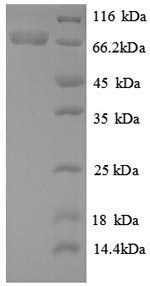 (Tris-Glycine gel) Discontinuous SDS-PAGE (reduced) with 5% enrichment gel and 15% separation gel. (Tris-Glycine gel) Discontinuous SDS-PAGE (reduced) with 5% enrichment gel and 15% separation gel.