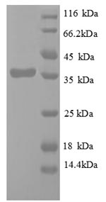 (Tris-Glycine gel) Discontinuous SDS-PAGE (reduced) with 5% enrichment gel and 15% separation gel.