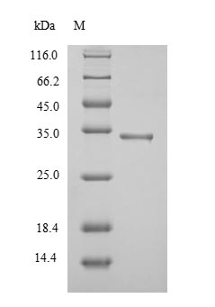 SDS-PAGE- Recombinant protein Mycobacterium fbpA
