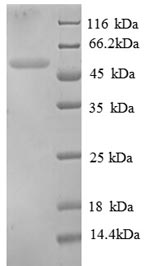 (Tris-Glycine gel) Discontinuous SDS-PAGE (reduced) with 5% enrichment gel and 15% separation gel. (Tris-Glycine gel) Discontinuous SDS-PAGE (reduced) with 5% enrichment gel and 15% separation gel.