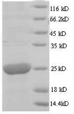 (Tris-Glycine gel) Discontinuous SDS-PAGE (reduced) with 5% enrichment gel and 15% separation gel. (Tris-Glycine gel) Discontinuous SDS-PAGE (reduced) with 5% enrichment gel and 15% separation gel.