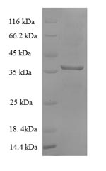 (Tris-Glycine gel) Discontinuous SDS-PAGE (reduced) with 5% enrichment gel and 15% separation gel.