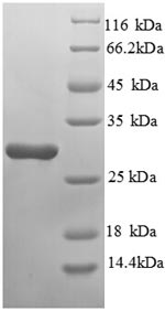 (Tris-Glycine gel) Discontinuous SDS-PAGE (reduced) with 5% enrichment gel and 15% separation gel. (Tris-Glycine gel) Discontinuous SDS-PAGE (reduced) with 5% enrichment gel and 15% separation gel.