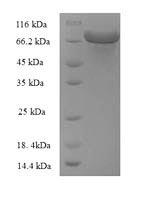 SDS-PAGE- Recombinant protein Escherichia zwf
