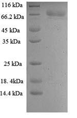 (Tris-Glycine gel) Discontinuous SDS-PAGE (reduced) with 5% enrichment gel and 15% separation gel.