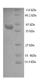 (Tris-Glycine gel) Discontinuous SDS-PAGE (reduced) with 5% enrichment gel and 15% separation gel.
