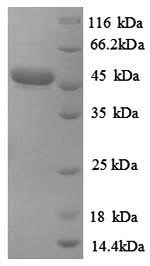 (Tris-Glycine gel) Discontinuous SDS-PAGE (reduced) with 5% enrichment gel and 15% separation gel.