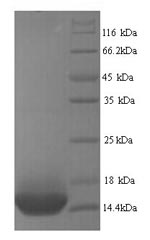 (Tris-Glycine gel) Discontinuous SDS-PAGE (reduced) with 5% enrichment gel and 15% separation gel. (Tris-Glycine gel) Discontinuous SDS-PAGE (reduced) with 5% enrichment gel and 15% separation gel.