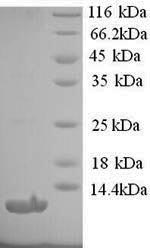 SDS-PAGE- Recombinant protein Human AGTR1