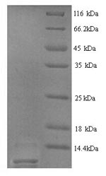 (Tris-Glycine gel) Discontinuous SDS-PAGE (reduced) with 5% enrichment gel and 15% separation gel. (Tris-Glycine gel) Discontinuous SDS-PAGE (reduced) with 5% enrichment gel and 15% separation gel.