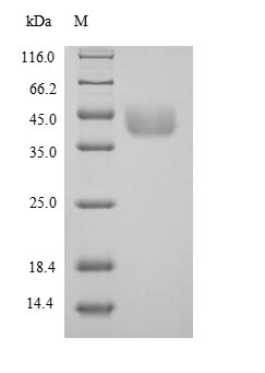 (Tris-Glycine gel) Discontinuous SDS-PAGE (reduced) with 5% enrichment gel and 15% separation gel. (Tris-Glycine gel) Discontinuous SDS-PAGE (reduced) with 5% enrichment gel and 15% separation gel.