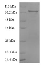 SDS-PAGE- Recombinant protein Macaca ALB