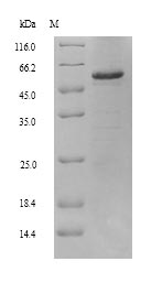(Tris-Glycine gel) Discontinuous SDS-PAGE (reduced) with 5% enrichment gel and 15% separation gel. (Tris-Glycine gel) Discontinuous SDS-PAGE (reduced) with 5% enrichment gel and 15% separation gel.