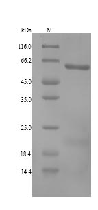 (Tris-Glycine gel) Discontinuous SDS-PAGE (reduced) with 5% enrichment gel and 15% separation gel. (Tris-Glycine gel) Discontinuous SDS-PAGE (reduced) with 5% enrichment gel and 15% separation gel.