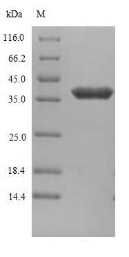 SDS-PAGE- Recombinant protein Human ANTXR1