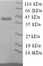 (Tris-Glycine gel) Discontinuous SDS-PAGE (reduced) with 5% enrichment gel and 15% separation gel.