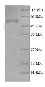 (Tris-Glycine gel) Discontinuous SDS-PAGE (reduced) with 5% enrichment gel and 15% separation gel. (Tris-Glycine gel) Discontinuous SDS-PAGE (reduced) with 5% enrichment gel and 15% separation gel.