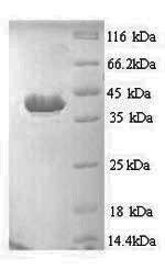 SDS-PAGE- Recombinant protein Human APAF1