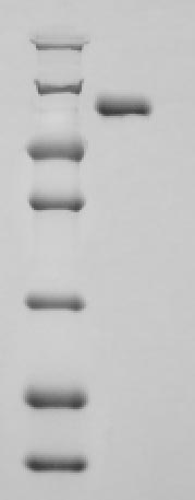 (Tris-Glycine gel) Discontinuous SDS-PAGE (reduced) with 5% enrichment gel and 15% separation gel. (Tris-Glycine gel) Discontinuous SDS-PAGE (reduced) with 5% enrichment gel and 15% separation gel.