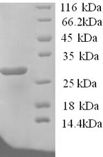 (Tris-Glycine gel) Discontinuous SDS-PAGE (reduced) with 5% enrichment gel and 15% separation gel. (Tris-Glycine gel) Discontinuous SDS-PAGE (reduced) with 5% enrichment gel and 15% separation gel.