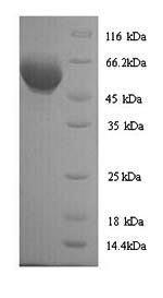 (Tris-Glycine gel) Discontinuous SDS-PAGE (reduced) with 5% enrichment gel and 15% separation gel. (Tris-Glycine gel) Discontinuous SDS-PAGE (reduced) with 5% enrichment gel and 15% separation gel.