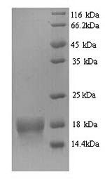 (Tris-Glycine gel) Discontinuous SDS-PAGE (reduced) with 5% enrichment gel and 15% separation gel. (Tris-Glycine gel) Discontinuous SDS-PAGE (reduced) with 5% enrichment gel and 15% separation gel.