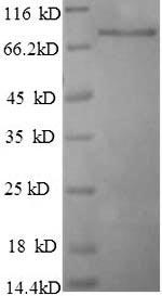 (Tris-Glycine gel) Discontinuous SDS-PAGE (reduced) with 5% enrichment gel and 15% separation gel. (Tris-Glycine gel) Discontinuous SDS-PAGE (reduced) with 5% enrichment gel and 15% separation gel.