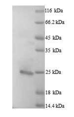 (Tris-Glycine gel) Discontinuous SDS-PAGE (reduced) with 5% enrichment gel and 15% separation gel. (Tris-Glycine gel) Discontinuous SDS-PAGE (reduced) with 5% enrichment gel and 15% separation gel.
