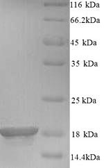(Tris-Glycine gel) Discontinuous SDS-PAGE (reduced) with 5% enrichment gel and 15% separation gel. (Tris-Glycine gel) Discontinuous SDS-PAGE (reduced) with 5% enrichment gel and 15% separation gel.