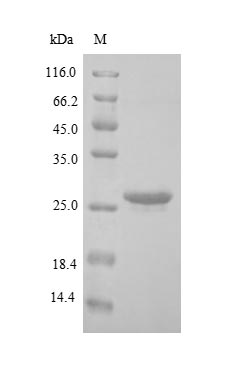 (Tris-Glycine gel) Discontinuous SDS-PAGE (reduced) with 5% enrichment gel and 15% separation gel. (Tris-Glycine gel) Discontinuous SDS-PAGE (reduced) with 5% enrichment gel and 15% separation gel.